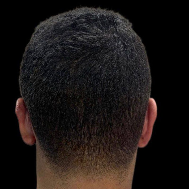 تجميل الاذنين 1-2