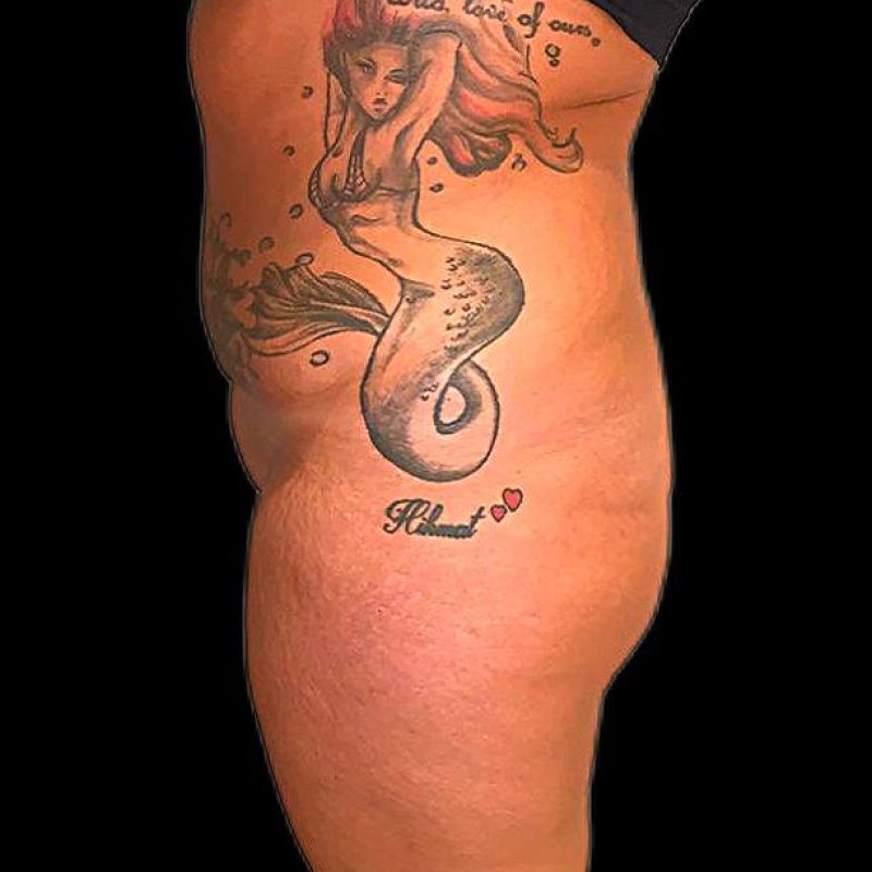 تكبير مؤخرة 5-1