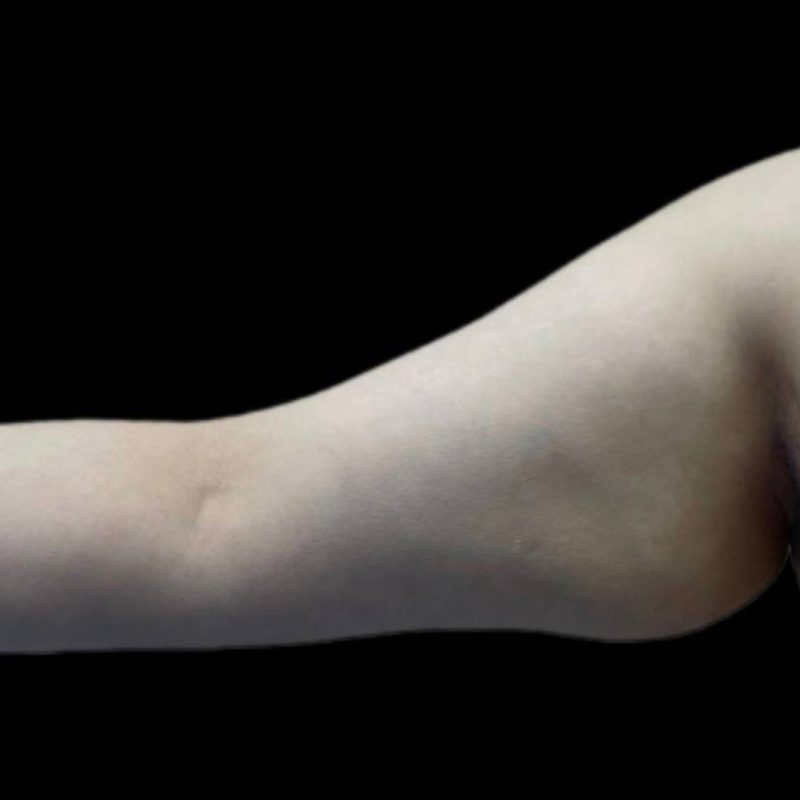 شد الذراعين 1-1