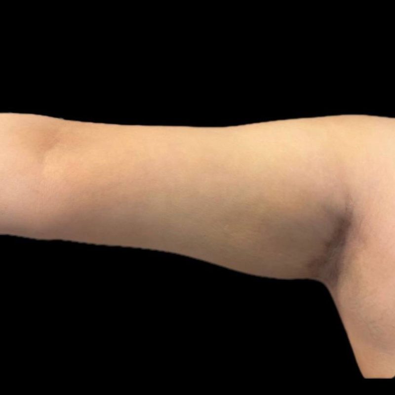 شد الذراعين 1-2