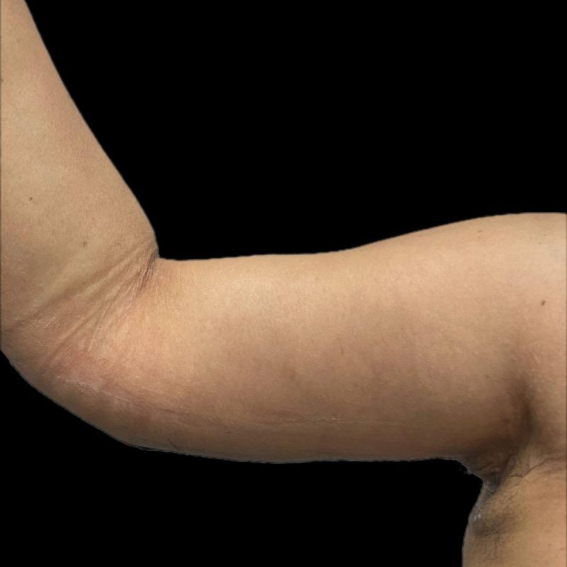 شد الذراعين 1-2