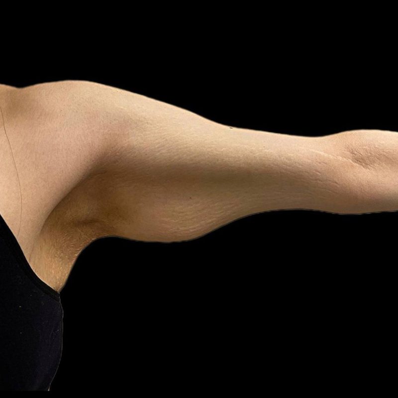 شد الذراعين 2-1