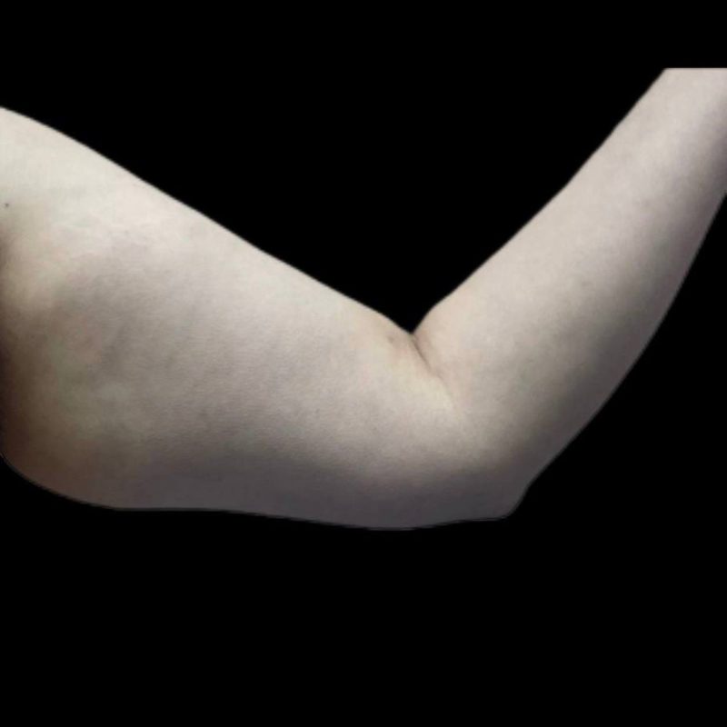 شد الذراعين 3-2