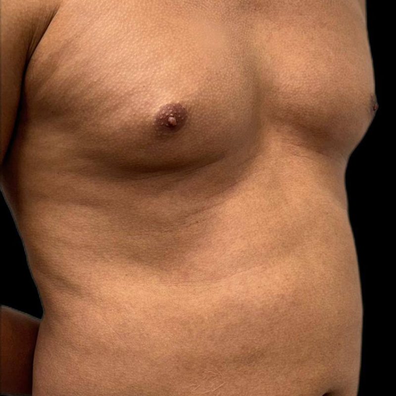 نحت الجسم للرجال 1-1