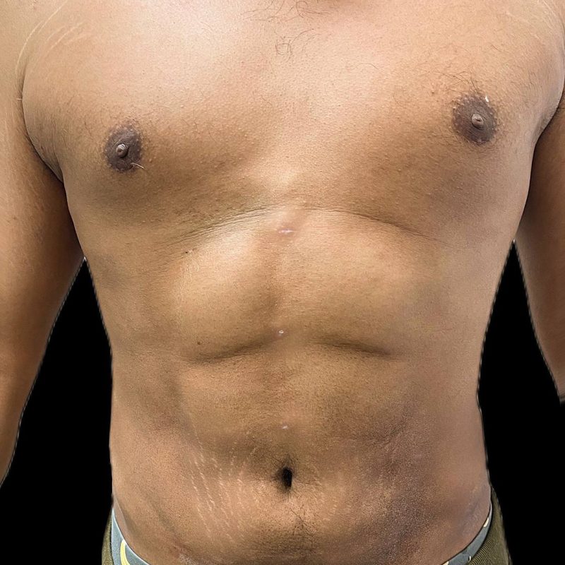 نحت الجسم للرجال 2-2