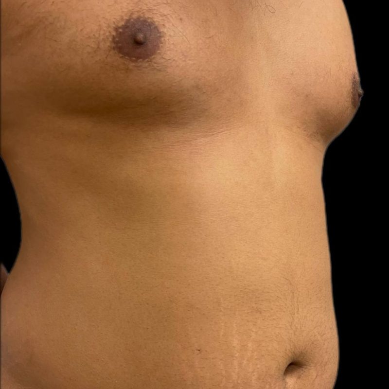 نحت الجسم للرجال 3-1