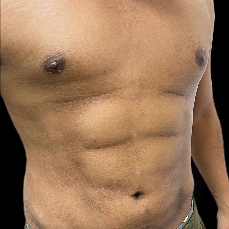 نحت الجسم للرجال 3-2