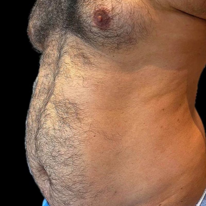 نحت الجسم للرجال 4-1