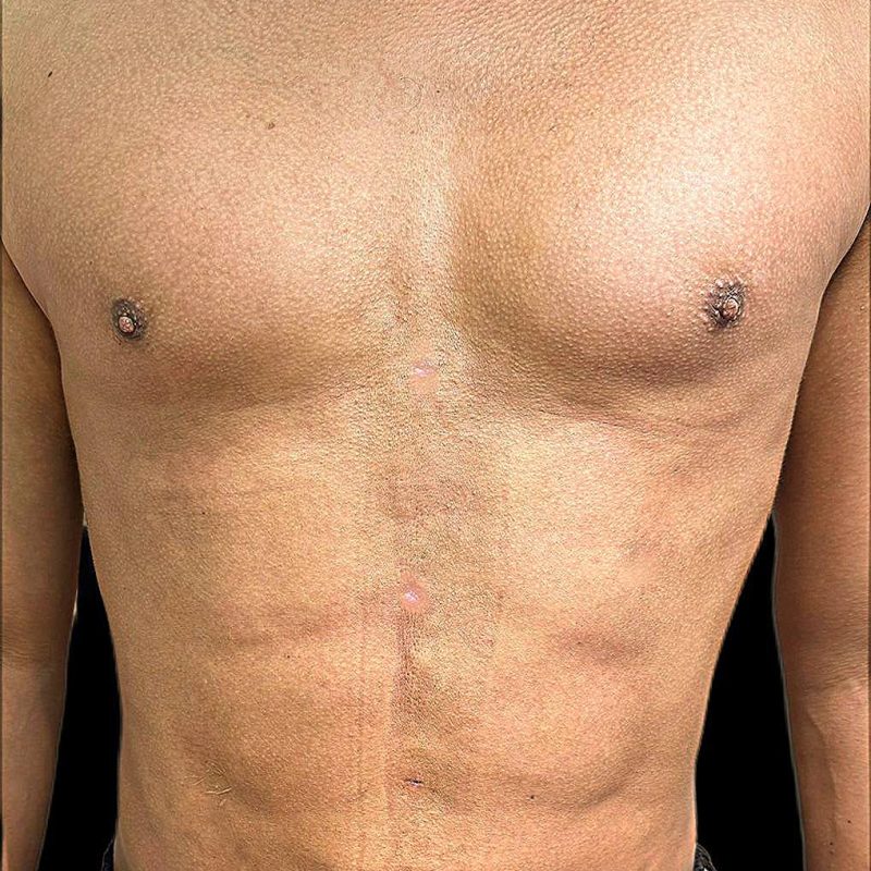 نحت الجسم للرجال 4-2