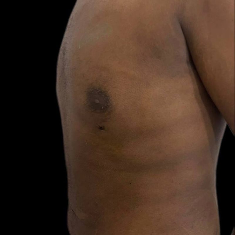 نحت الجسم للرجال 5-2