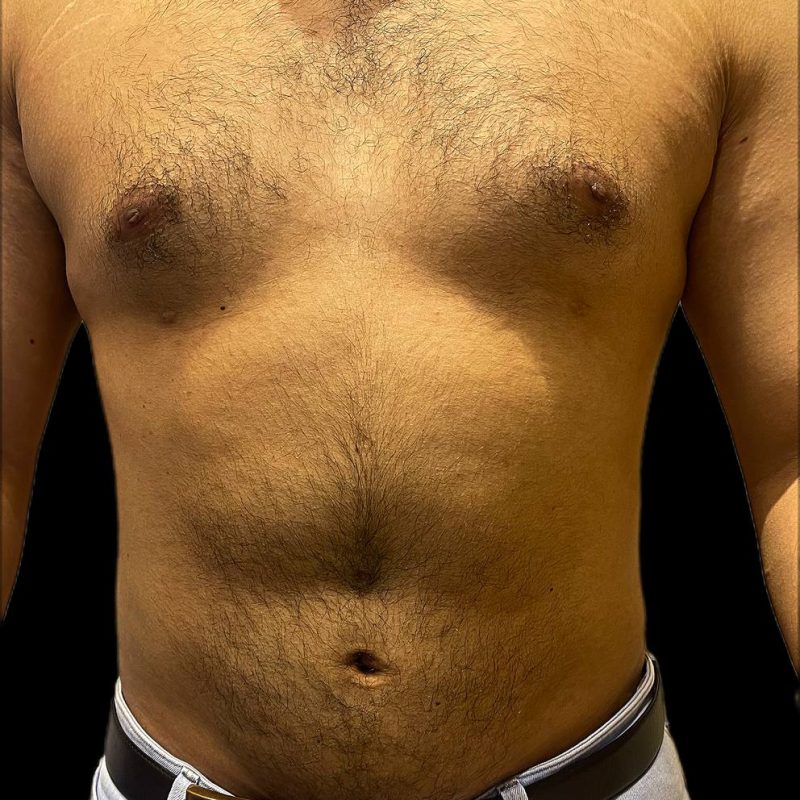 نحت الجسم للرجال 5-2